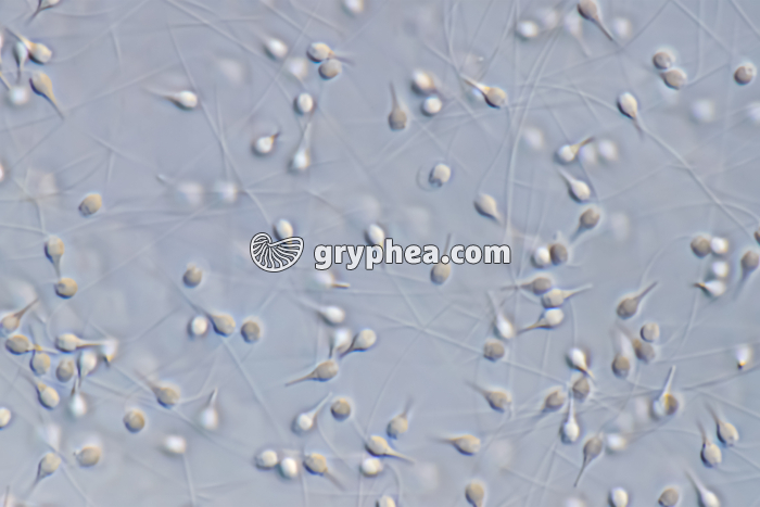 Spermatozoïdes de Moule (Mytilus edulis) x250 - gryphea.com